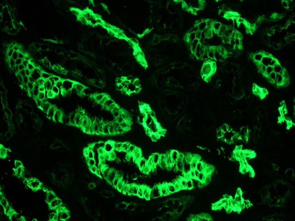 Figure 4: Frozen section of human kidney tissue immunostained with MUB0316, showing strong reactivity in the epithelial cells of the tubules.